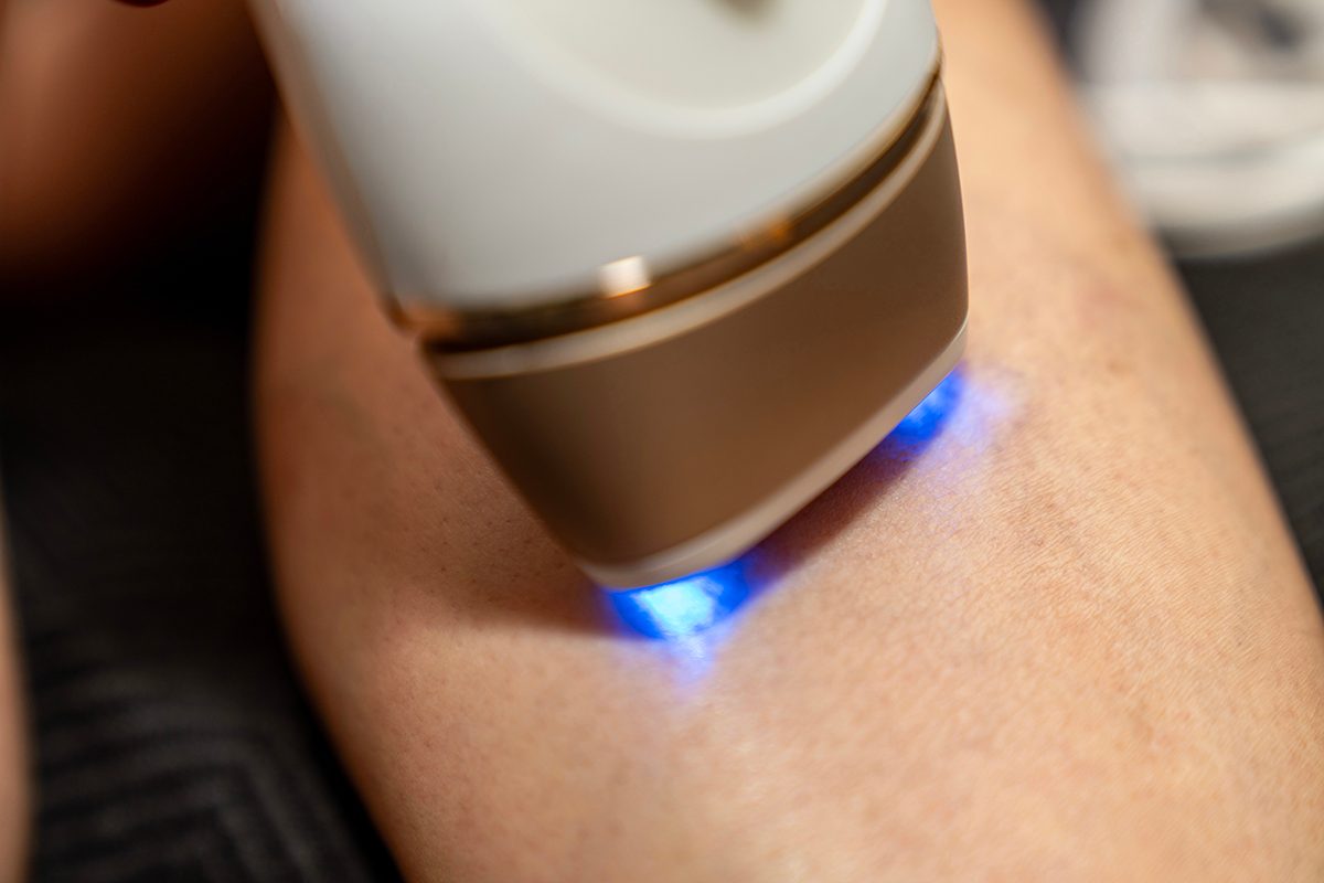 A close-up of a person using an IPL device on their leg