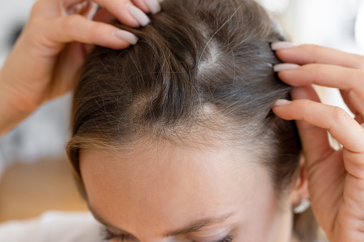A woman parting her hair to reveal her scalp