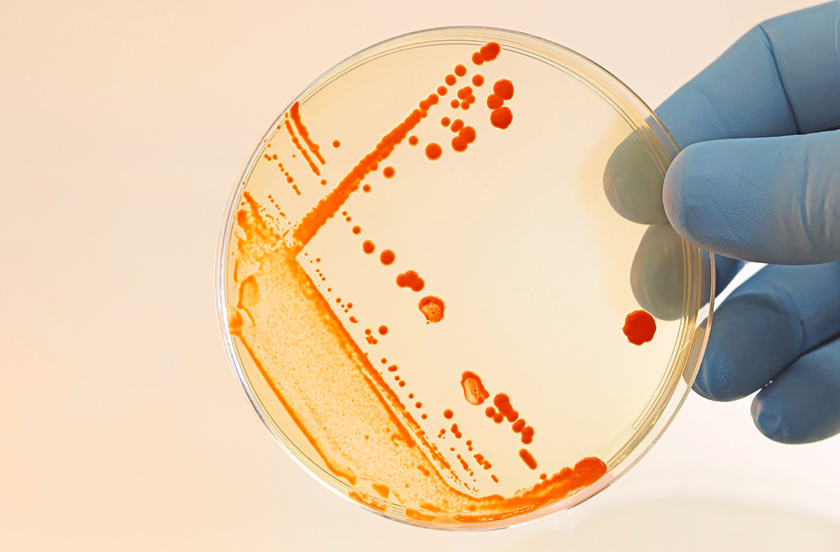 A hand wearing a blue glove is holding up a Petri dish containing bacteria