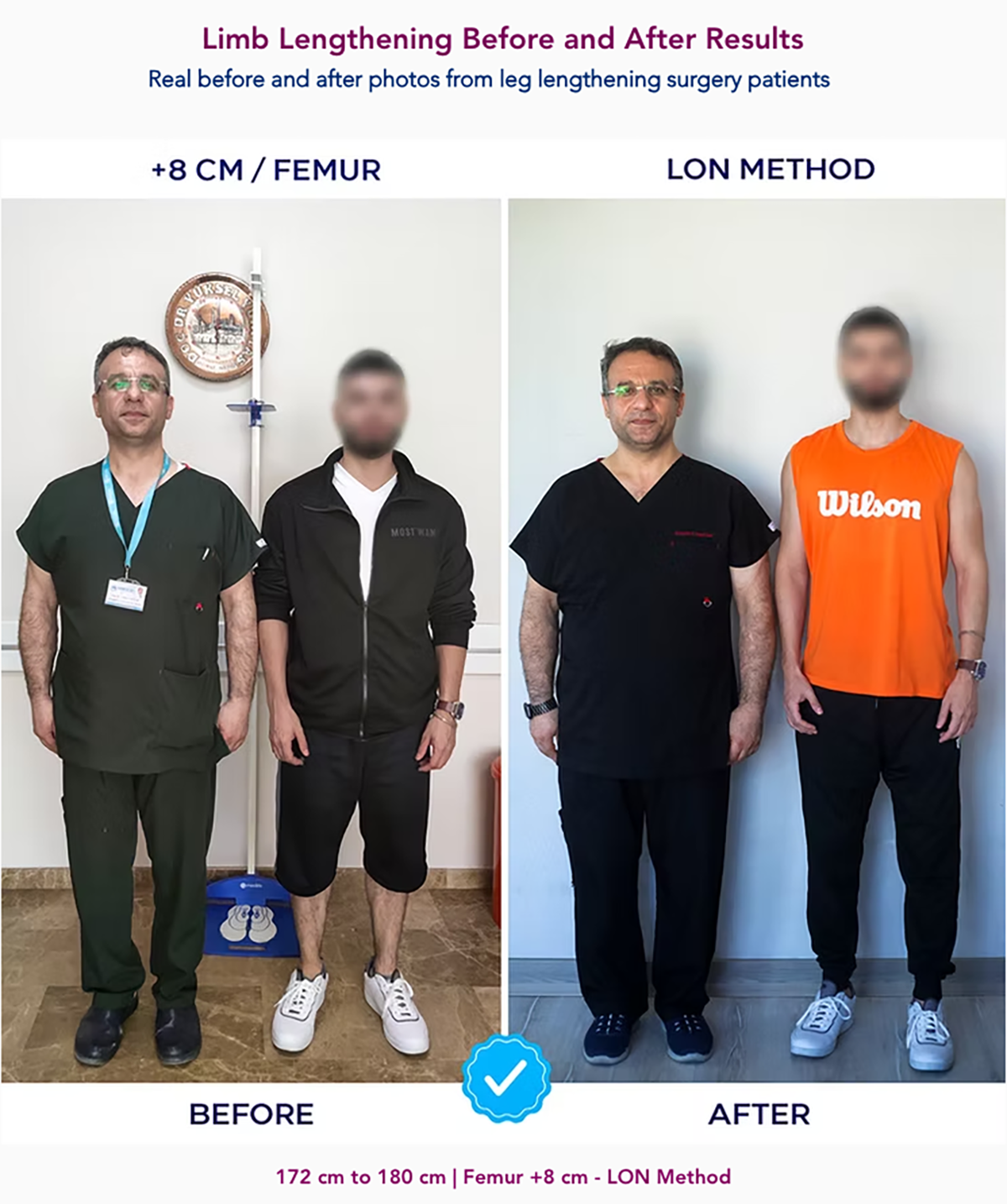 A before-and-after of a man who has undergone a limb lengthening procedure