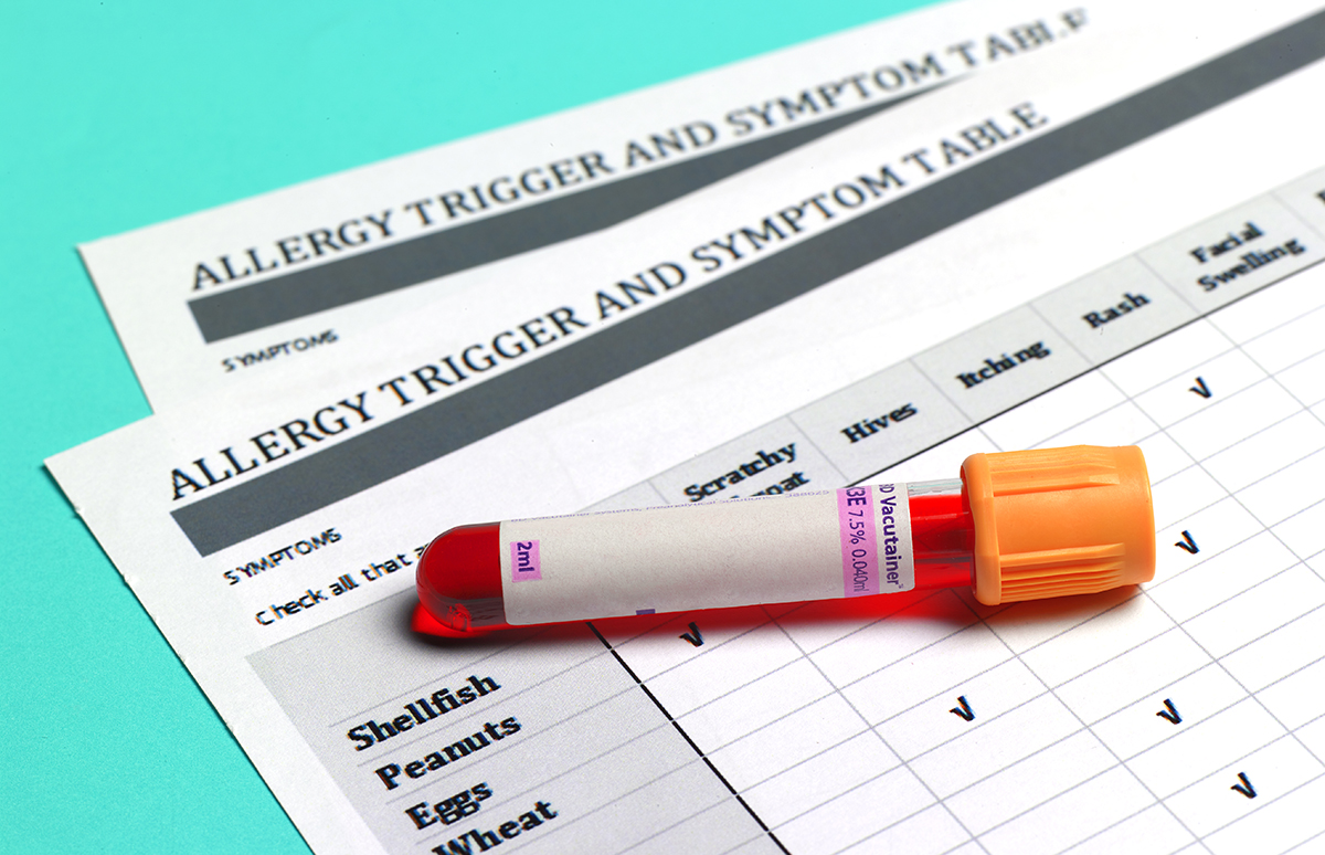 A blood sample on top of two allergy logs