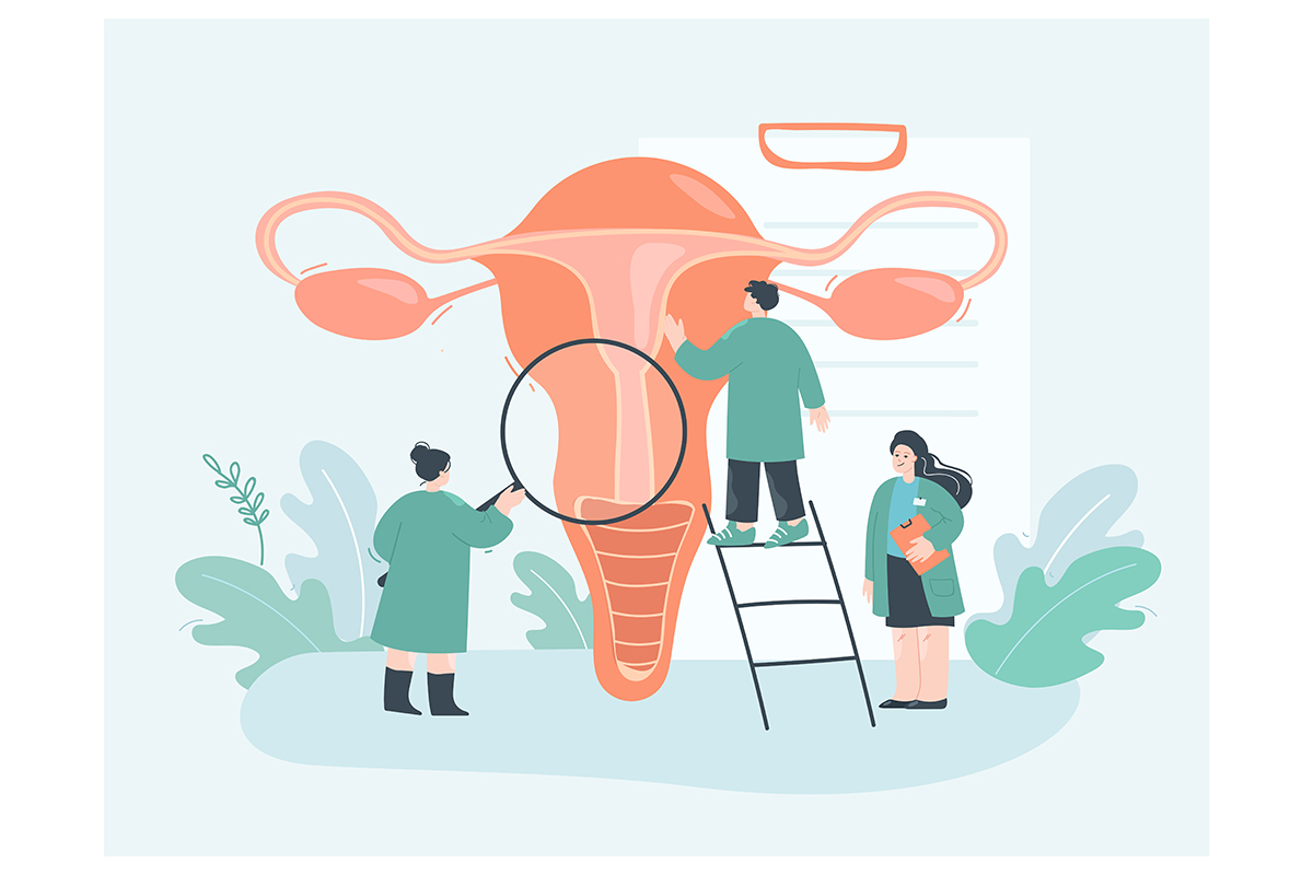 An illustration of three medical professionals examining a uterus