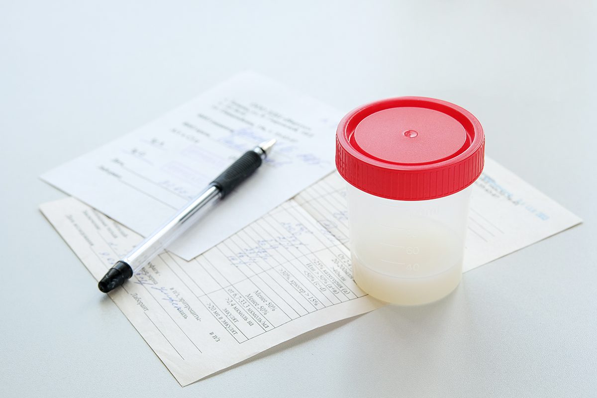 A specimen container and pen on top of forms