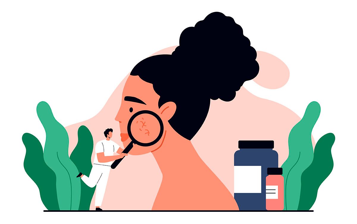 A cartoon-style illustration of a dermatologist holding up a magnifying glass to a woman's cheek and examining rosacea