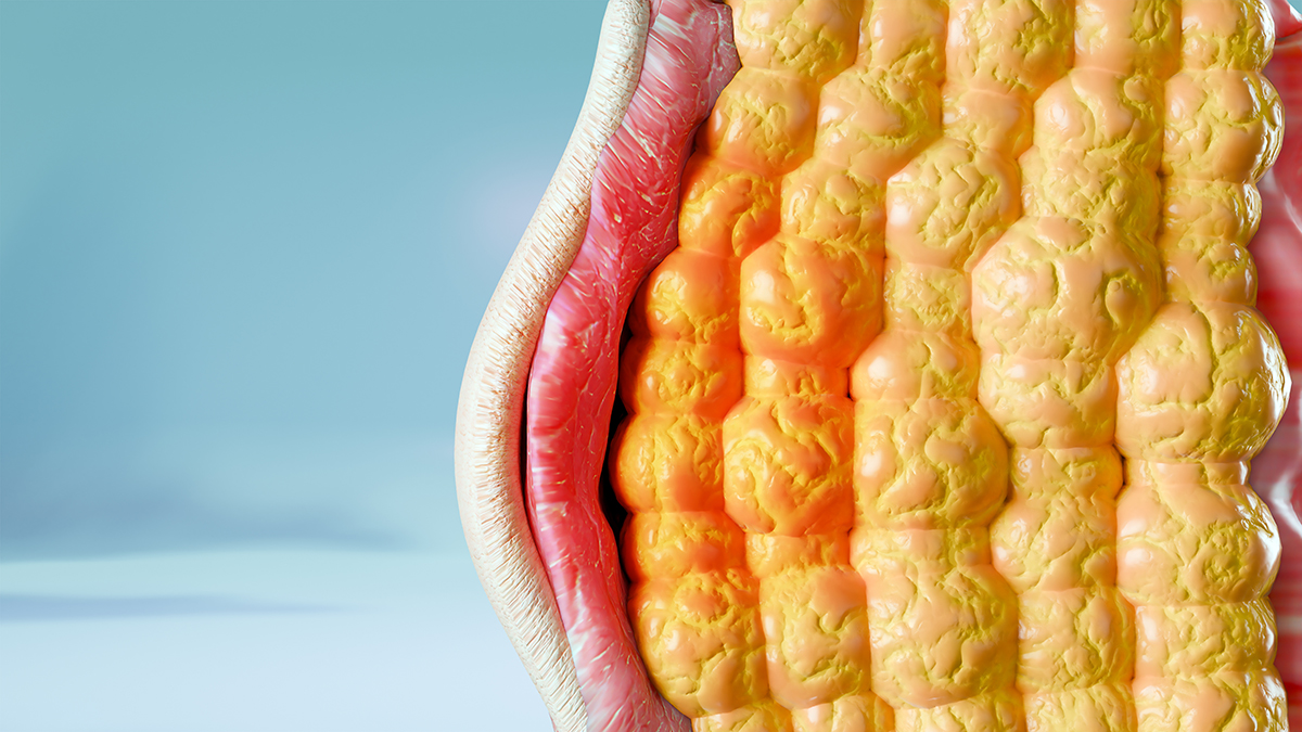 A 3D rendered image of fat under the skin