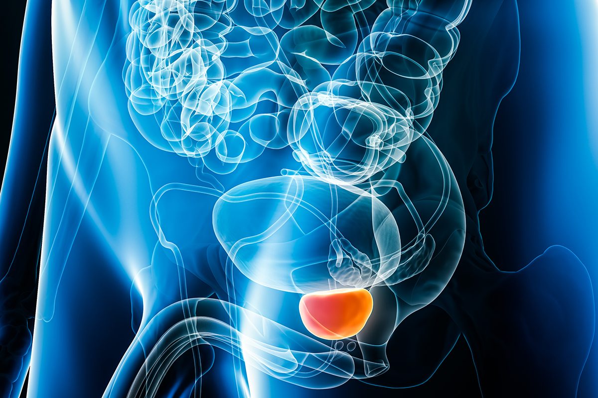 An X-ray image of a man's body with the prostate highlighted in orange