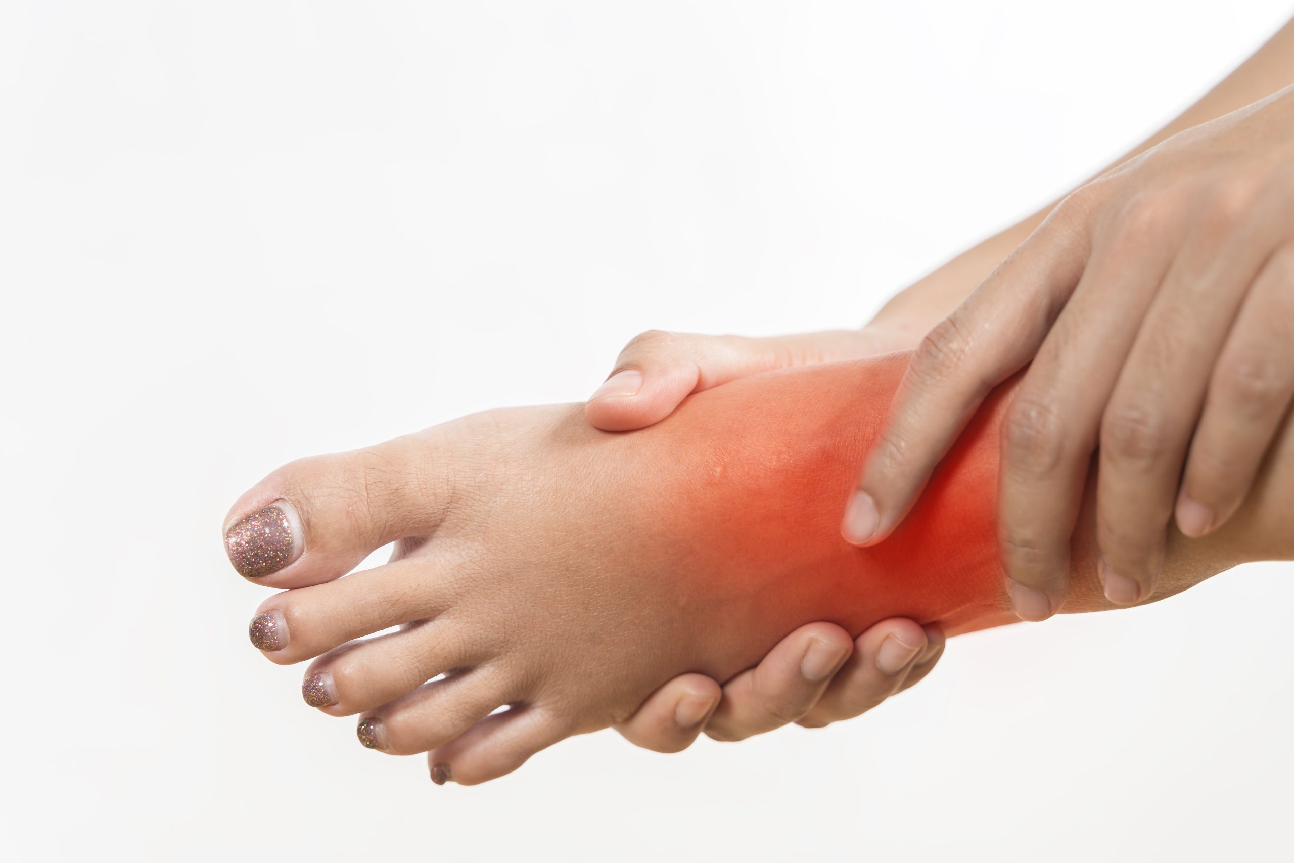 A person is holding their foot and it is red and swollen. The person is in pain and is trying to relieve it