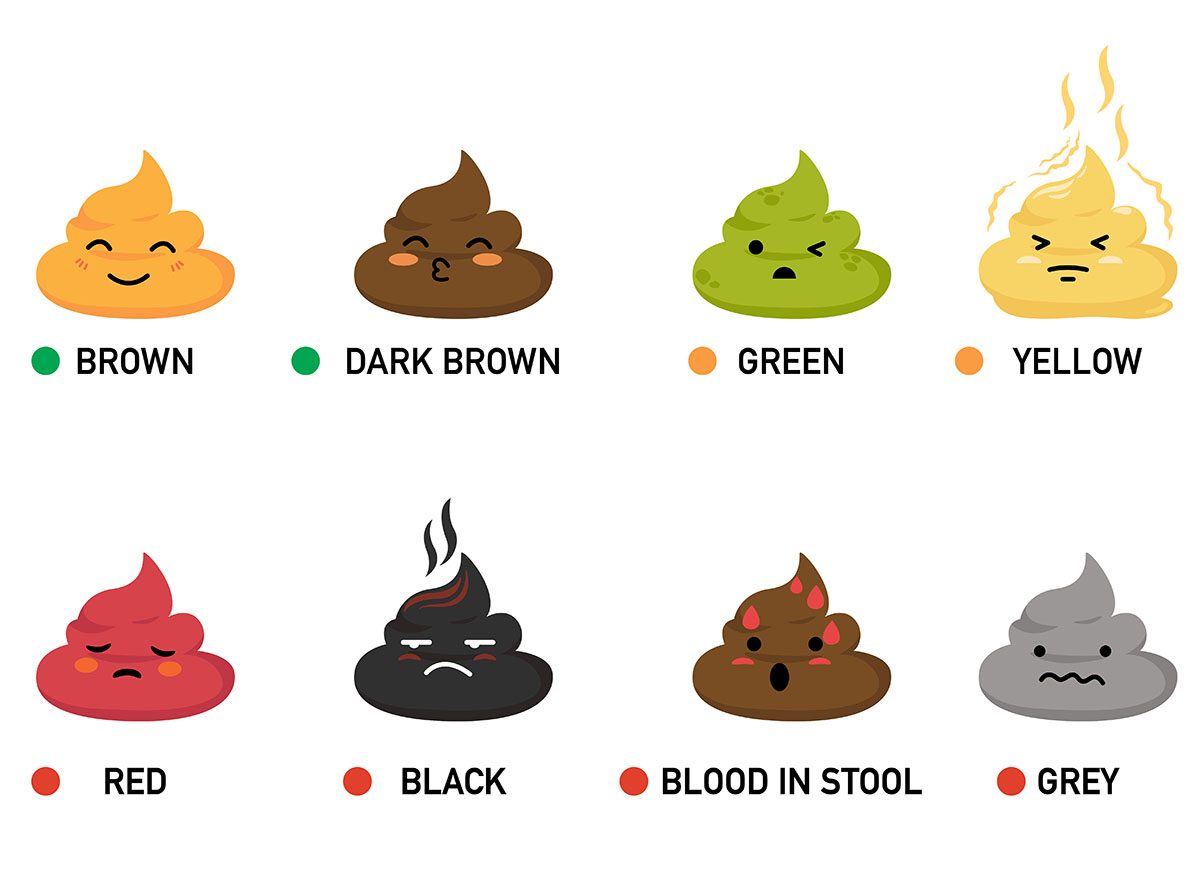 A vector illustration of different stool colours