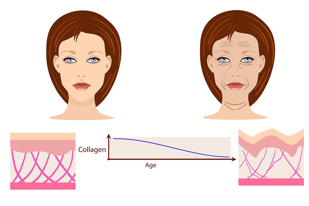 Illustration of two female faces side by side, one with smooth skin and the other with wrinkles, highlighting aging effects. Underneath, a graph depicts collagen loss over time, with collagen fibres breaking down.