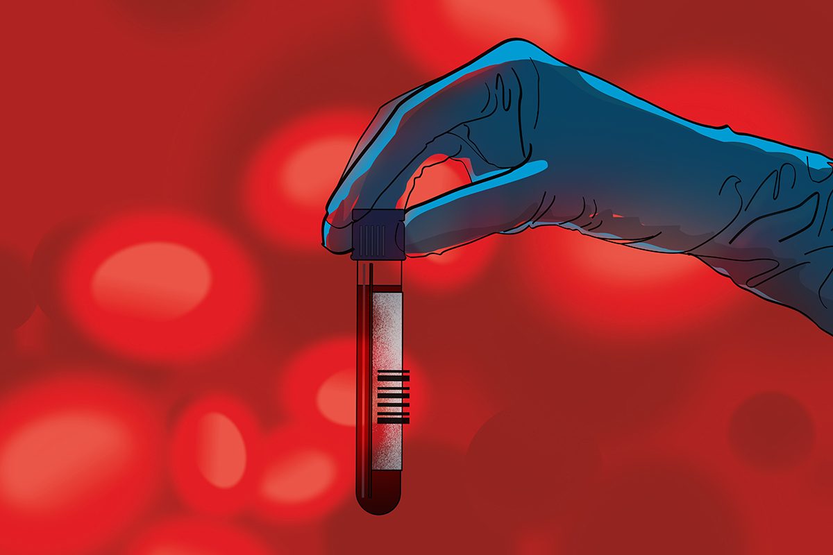 A cartoon-style illustration of a hand holding a blood sample