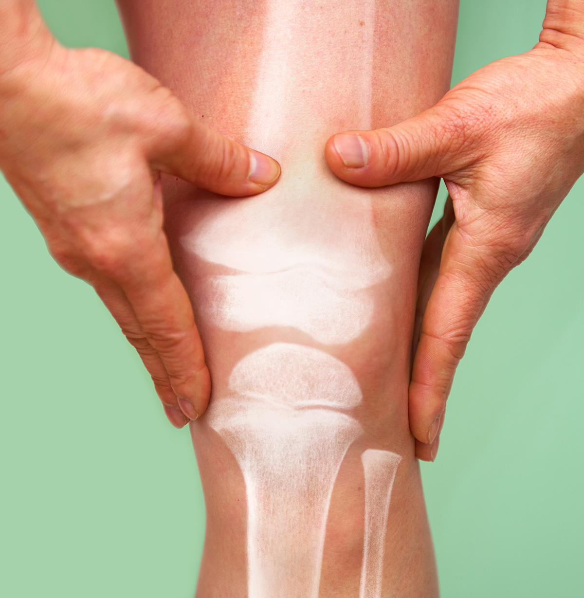 Hands holding a leg with an X-ray image of the knee