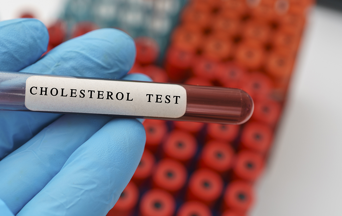 Cholesterol blood test