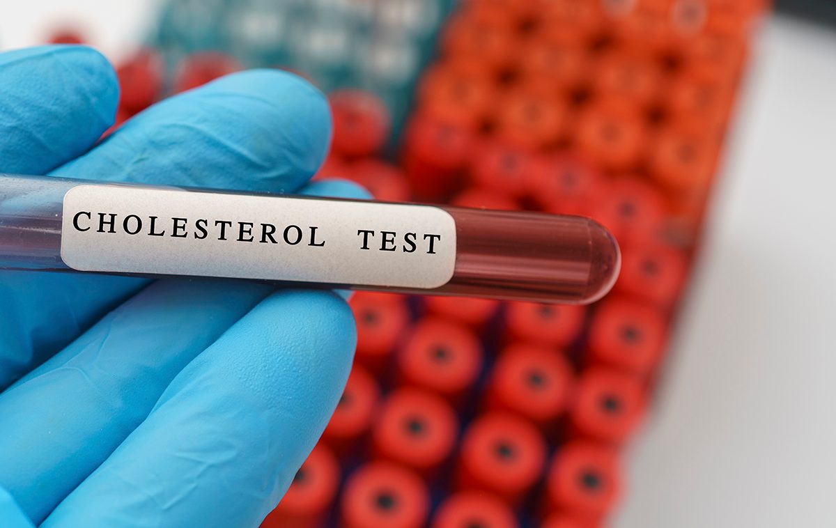 Cholesterol blood test