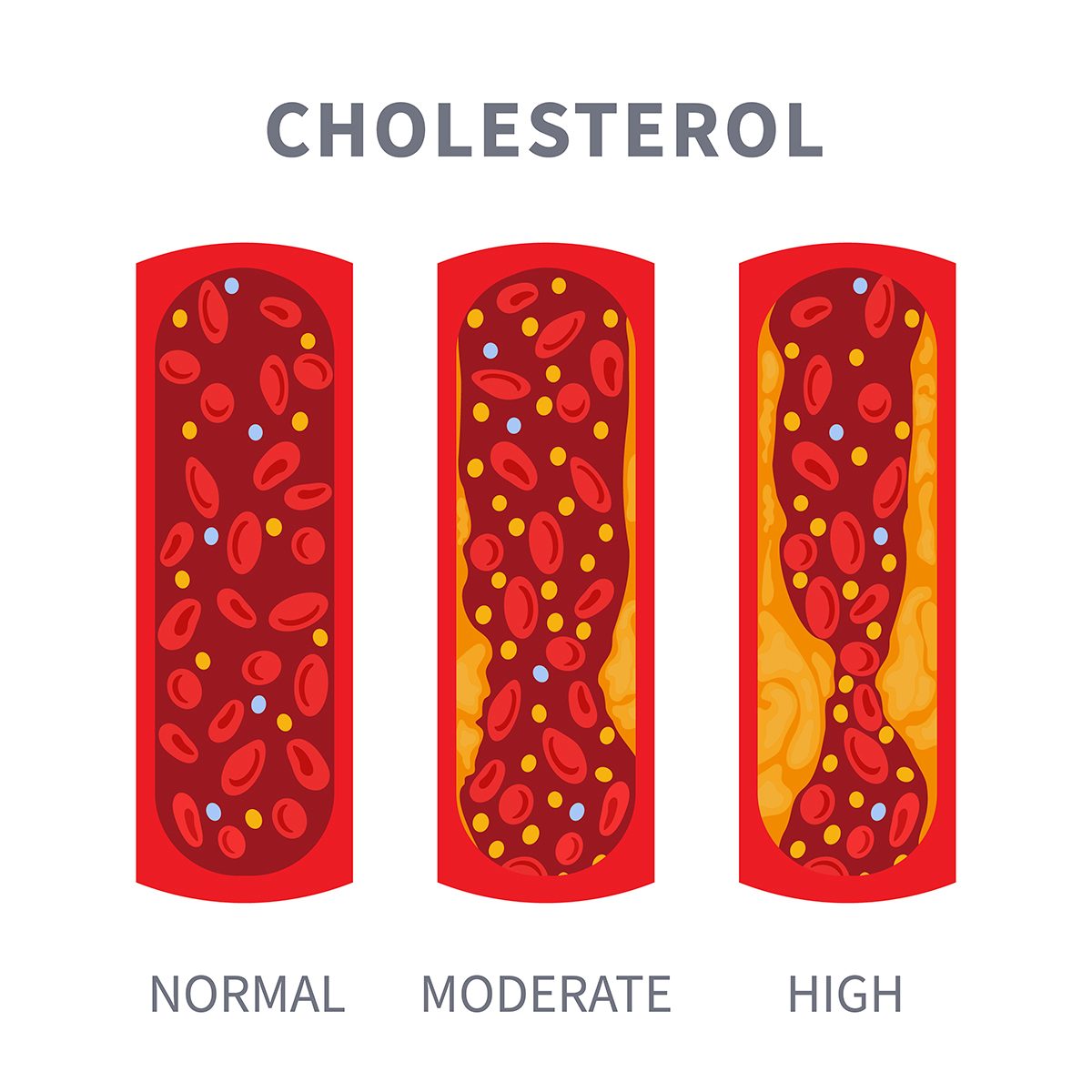 cholesterol diagram